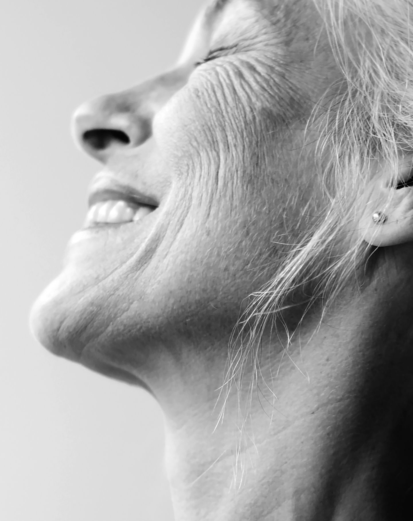 Revance Therapeutics model smiling