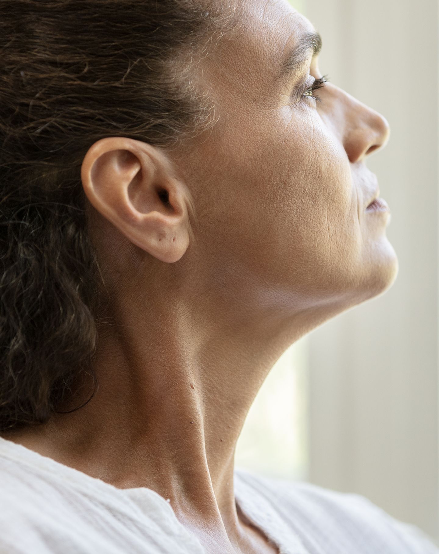 Daxxify Cervical dystonia Patient